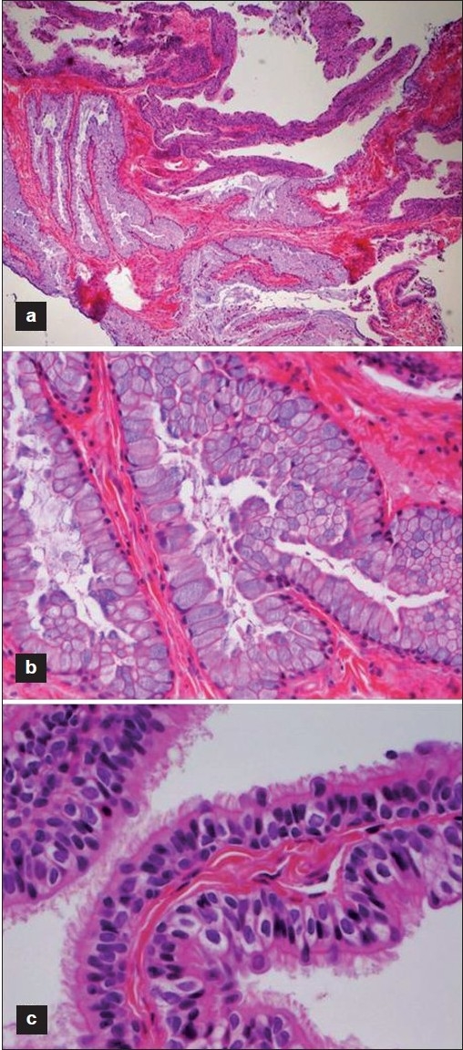 Neurenteric cysts of the spine – ScienceOpen