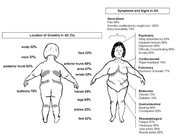 Lipoma | Doctor | Patient