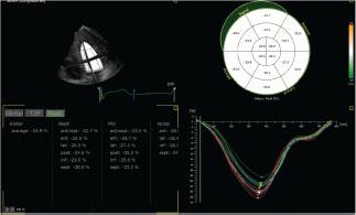 A Test in Context: Myocardial Strain Measured by Speckle-Tracking  Echocardiography