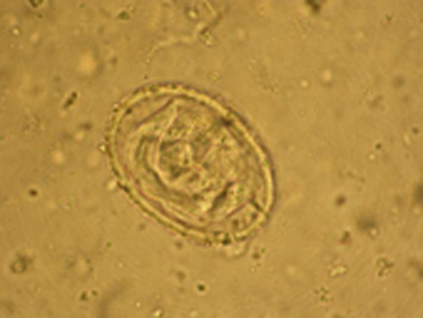 Metastrongylus spp. infection in a farmed wild boar (Sus scrofa) in ...