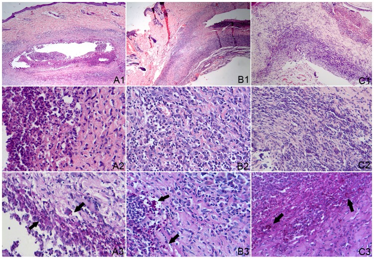 Taenia taeniaeformis in Rat Favors Protracted Skin Lesions Caused by ...