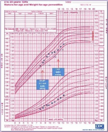 Precocious puberty in Turner Syndrome: report of a case and review of ...