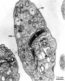 trypanosoma cruzi epimastigote